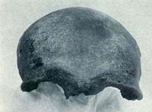 Amaghino Skull